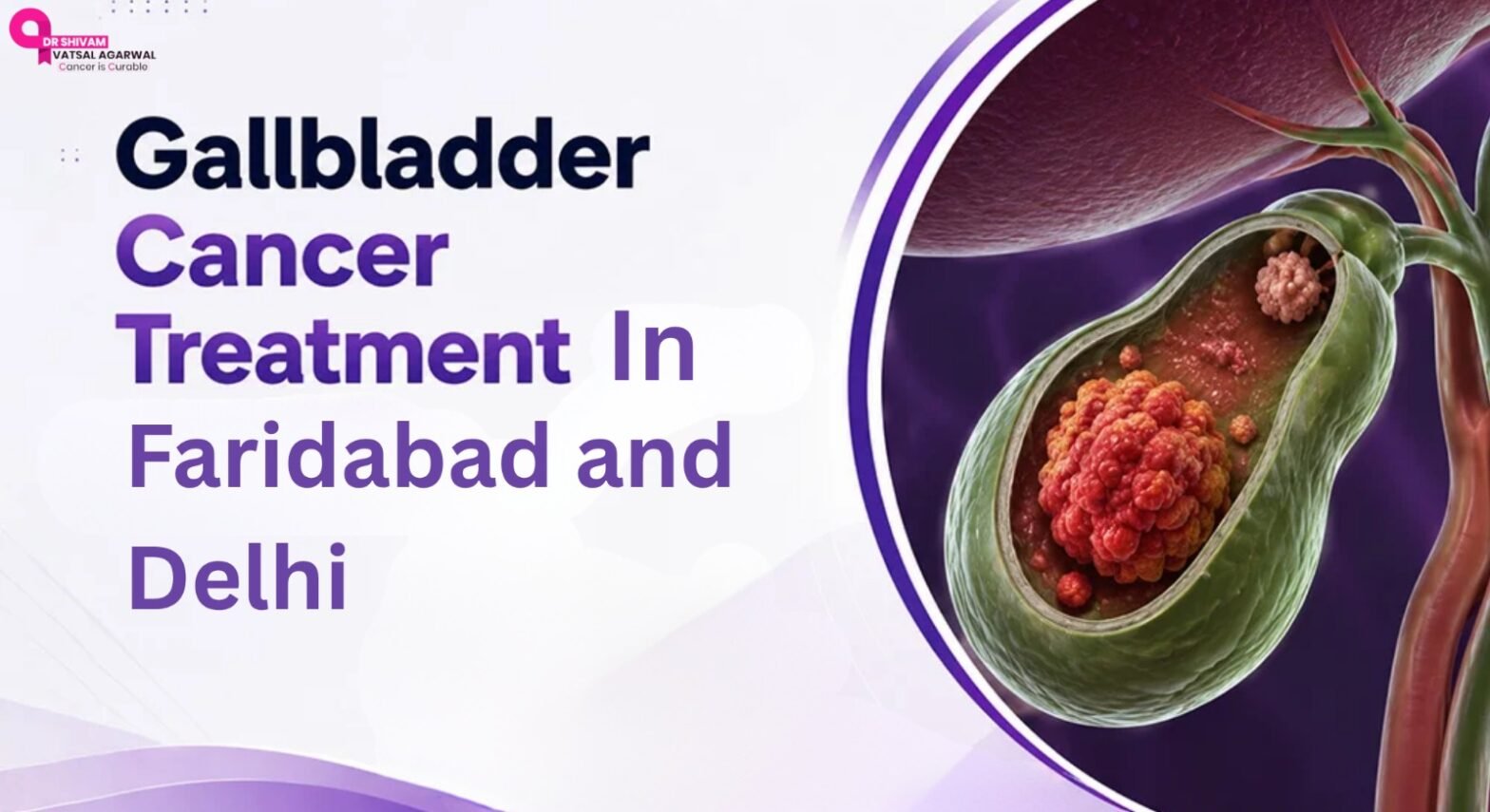 Gallbladder cancer treatment in Faridabad and Delhi