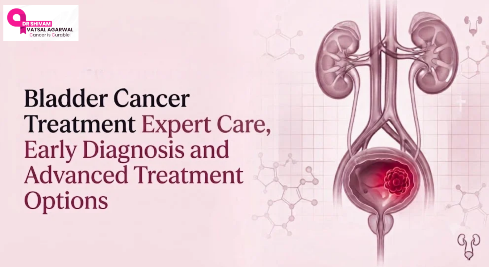 Bladder cancer treatment in Faridabad by Dr. Shivam Vatsal Agarwal