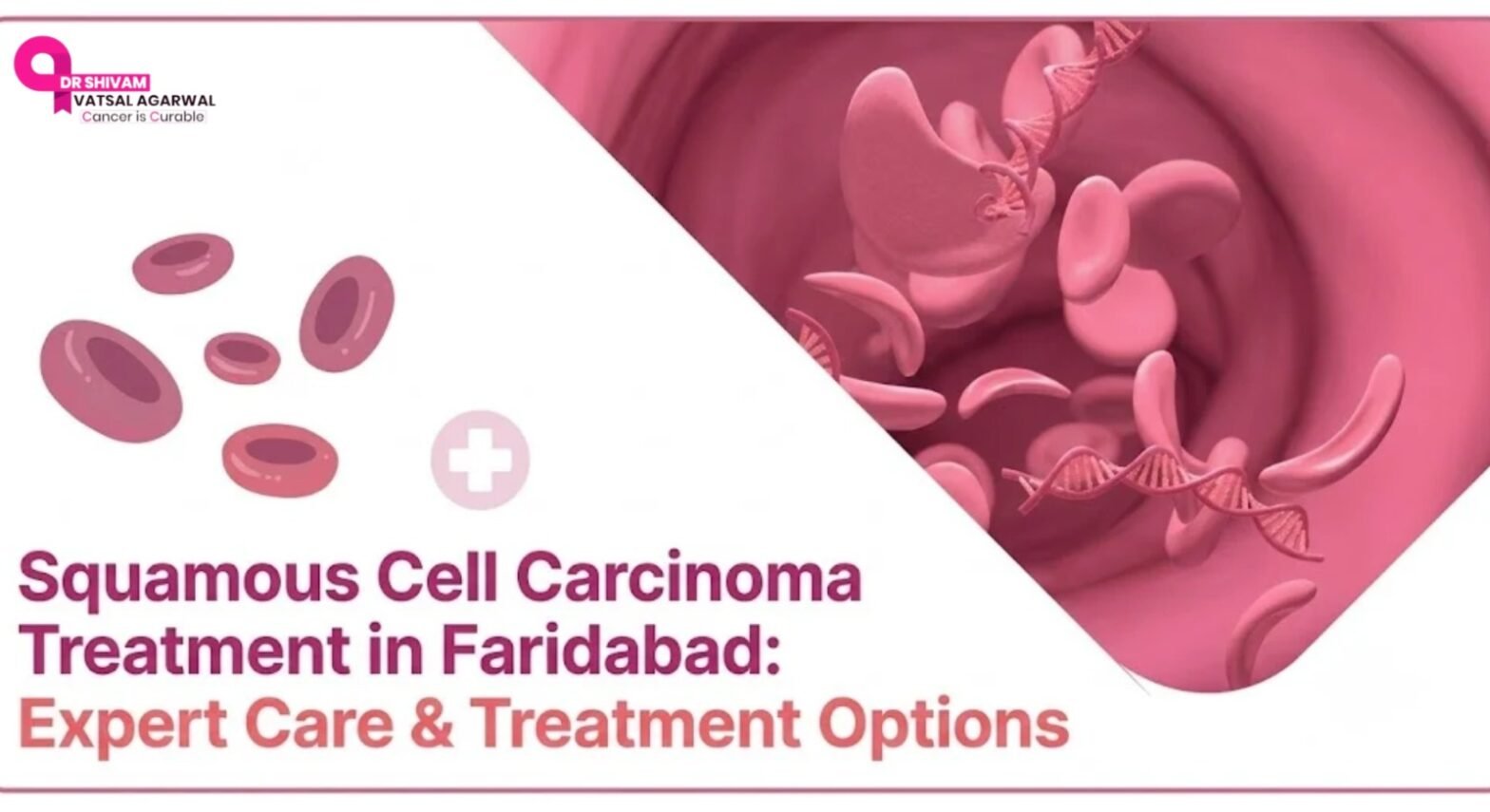 Squamous cell carcinoma treatment and skin cancer care in Faridabad